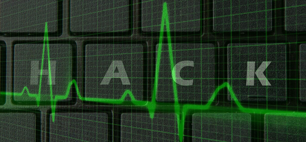 Cybersecurity concept: the word "HACK," spelled on keys from a computer keyboard, is superimposed over an electrocardiogram measurement.
