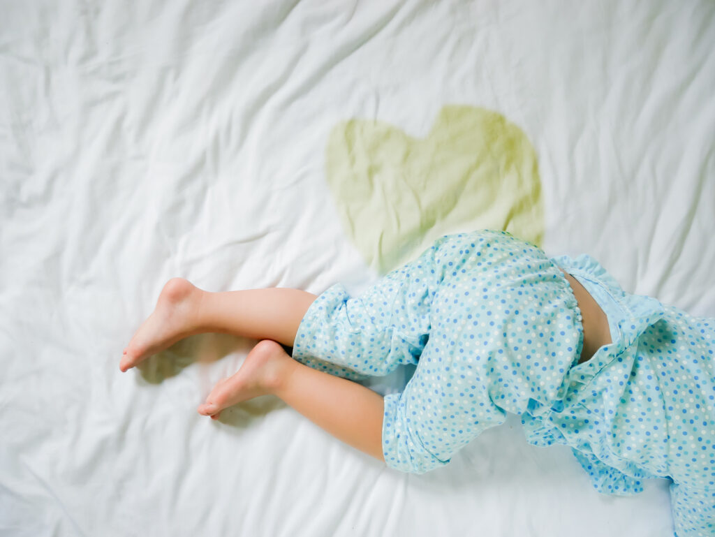 A child rolls over in bed after having urinated on white sheets.
